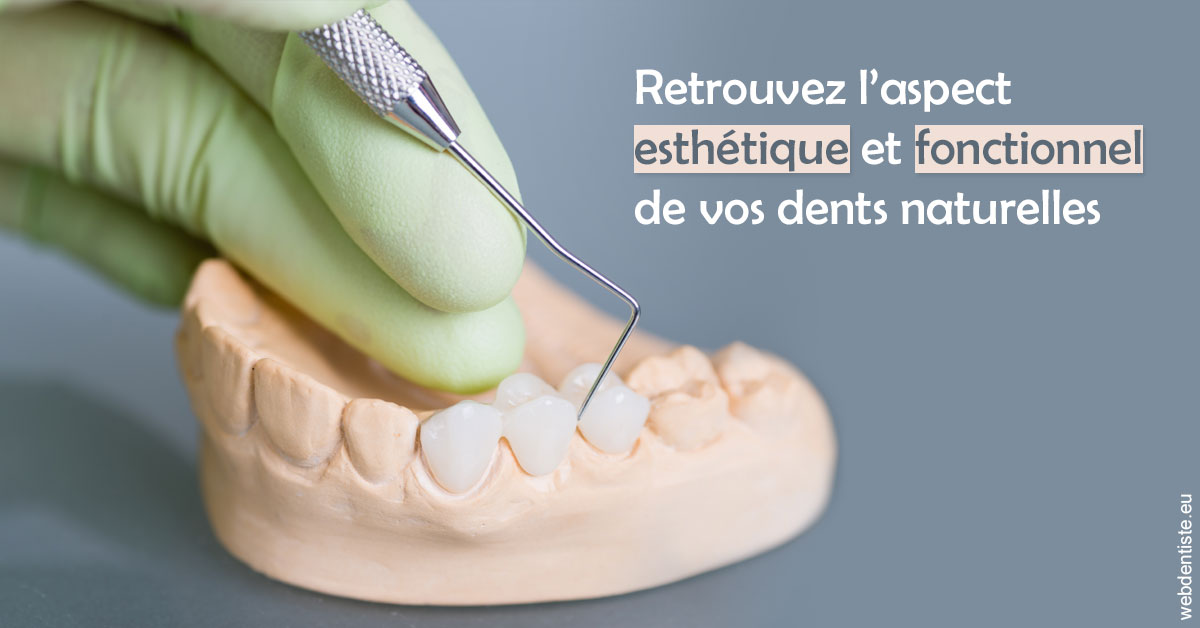 https://www.orthodontie-nappee.fr/Restaurations dentaires 1