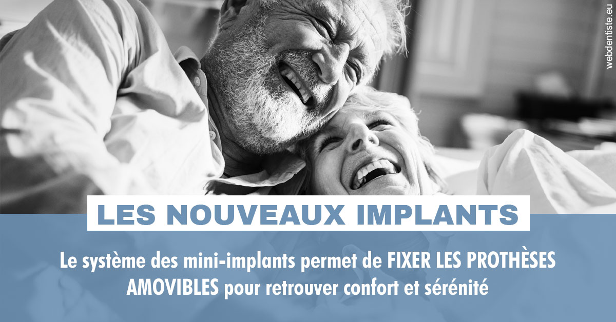 https://www.orthodontie-nappee.fr/Les nouveaux implants 2