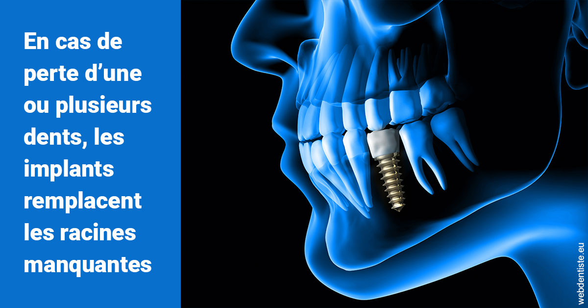 https://www.orthodontie-nappee.fr/Les implants 1