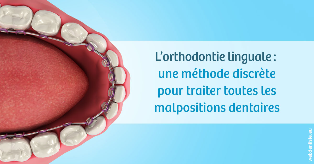 https://www.orthodontie-nappee.fr/L'orthodontie linguale 1