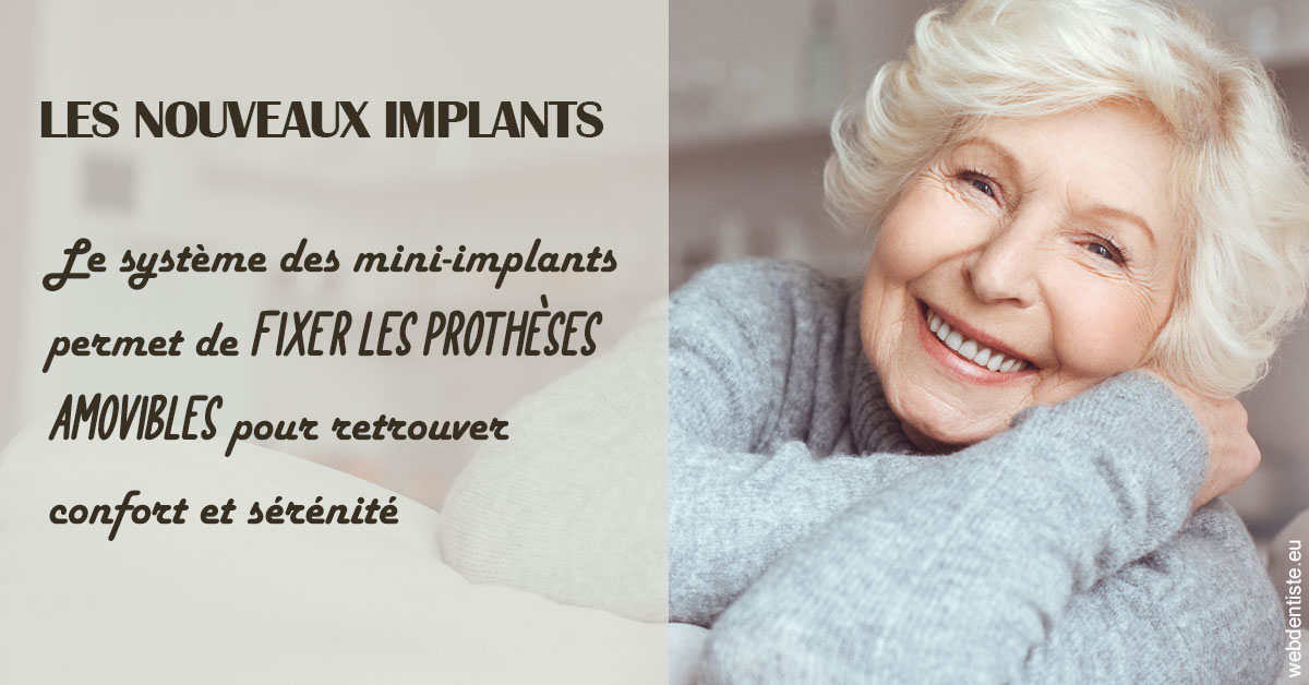 https://www.orthodontie-nappee.fr/Les nouveaux implants 1