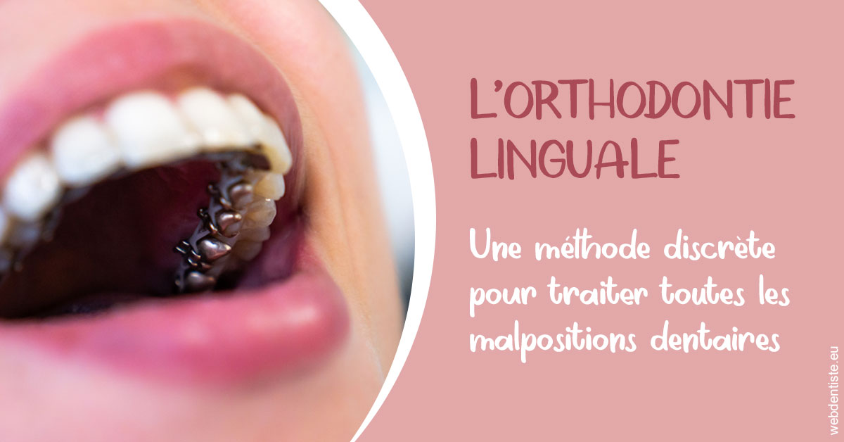 https://www.orthodontie-nappee.fr/L'orthodontie linguale 2