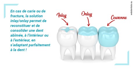 https://www.orthodontie-nappee.fr/L'INLAY ou l'ONLAY