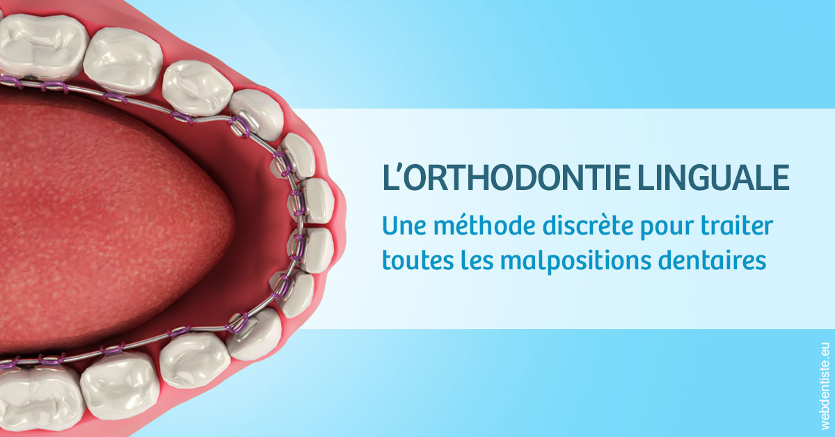 https://www.orthodontie-nappee.fr/L'orthodontie linguale 1