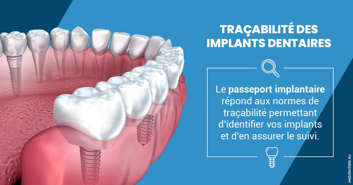 https://www.orthodontie-nappee.fr/T2 2023 - Traçabilité des implants 1