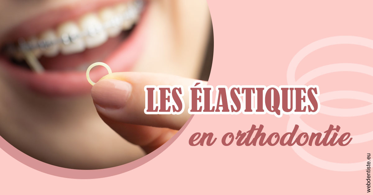 https://www.orthodontie-nappee.fr/Elastiques orthodontie 1