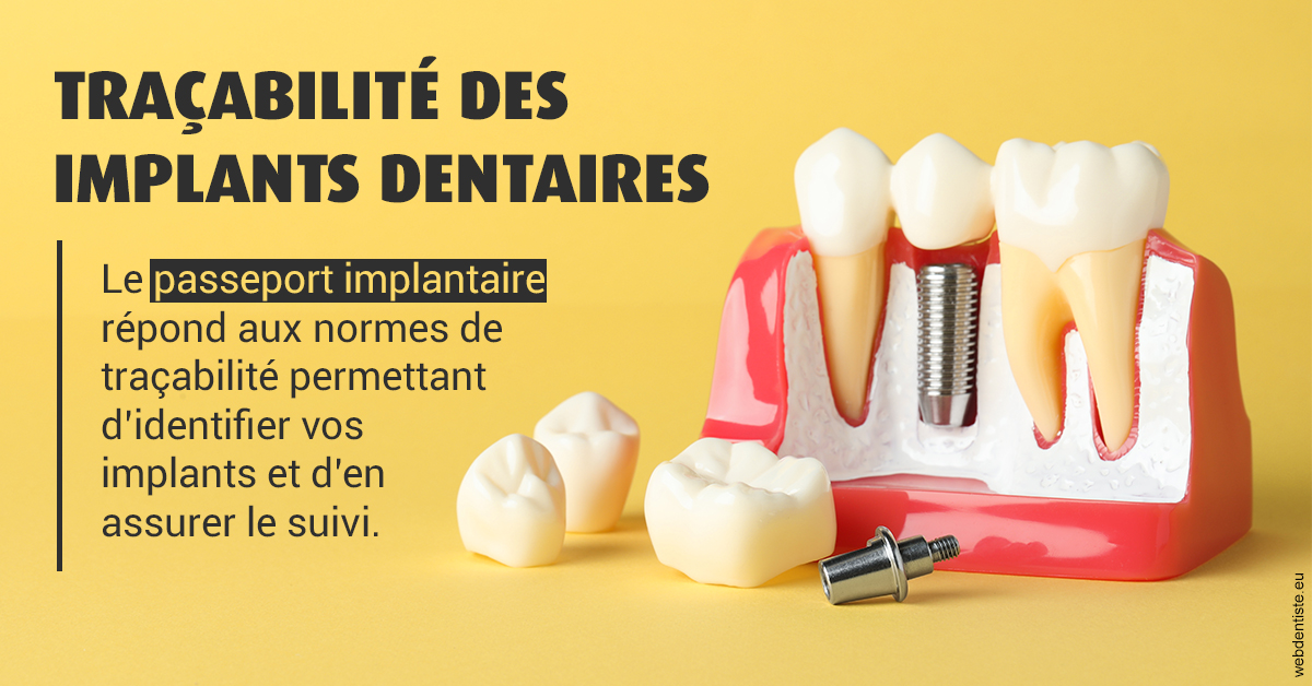 https://www.orthodontie-nappee.fr/T2 2023 - Traçabilité des implants 2