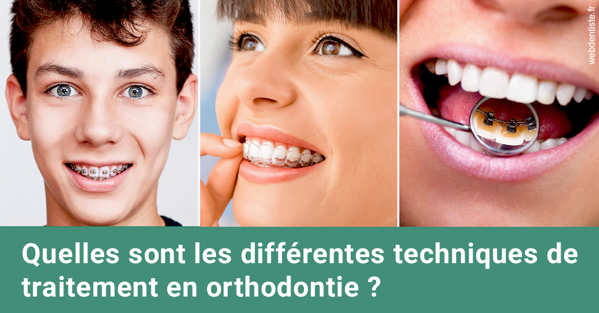 https://www.orthodontie-nappee.fr/Les différentes techniques de traitement 2