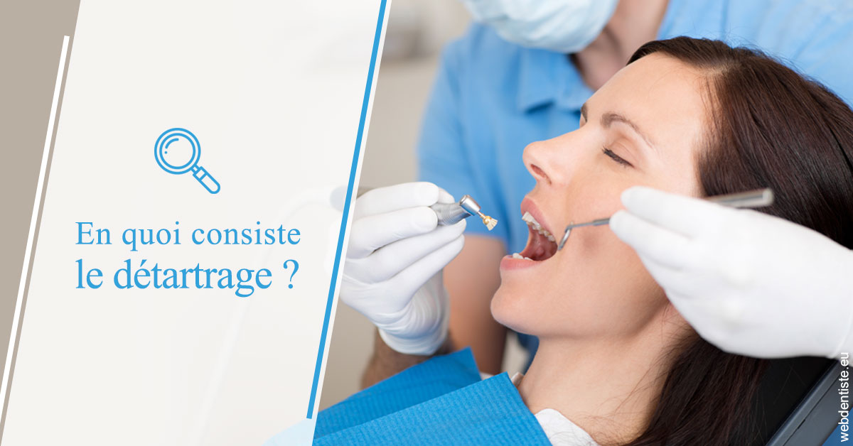 https://www.orthodontie-nappee.fr/En quoi consiste le détartrage