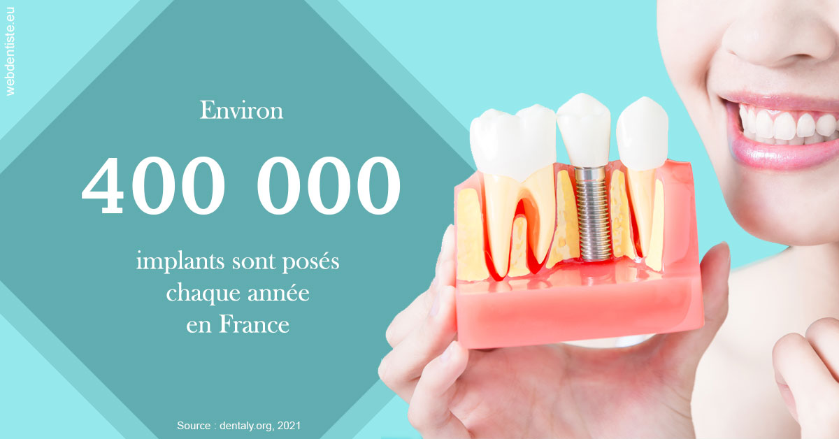 https://www.orthodontie-nappee.fr/Pose d'implants en France 2