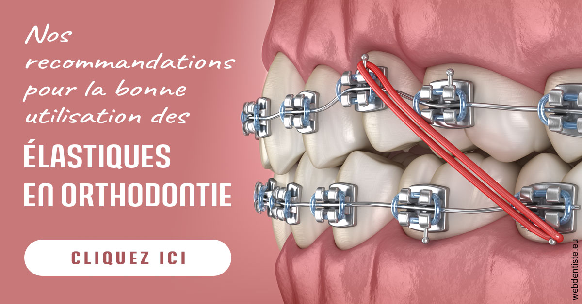 https://www.orthodontie-nappee.fr/Elastiques orthodontie 2